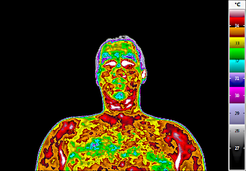 Patient mit UFO-Farbkeil